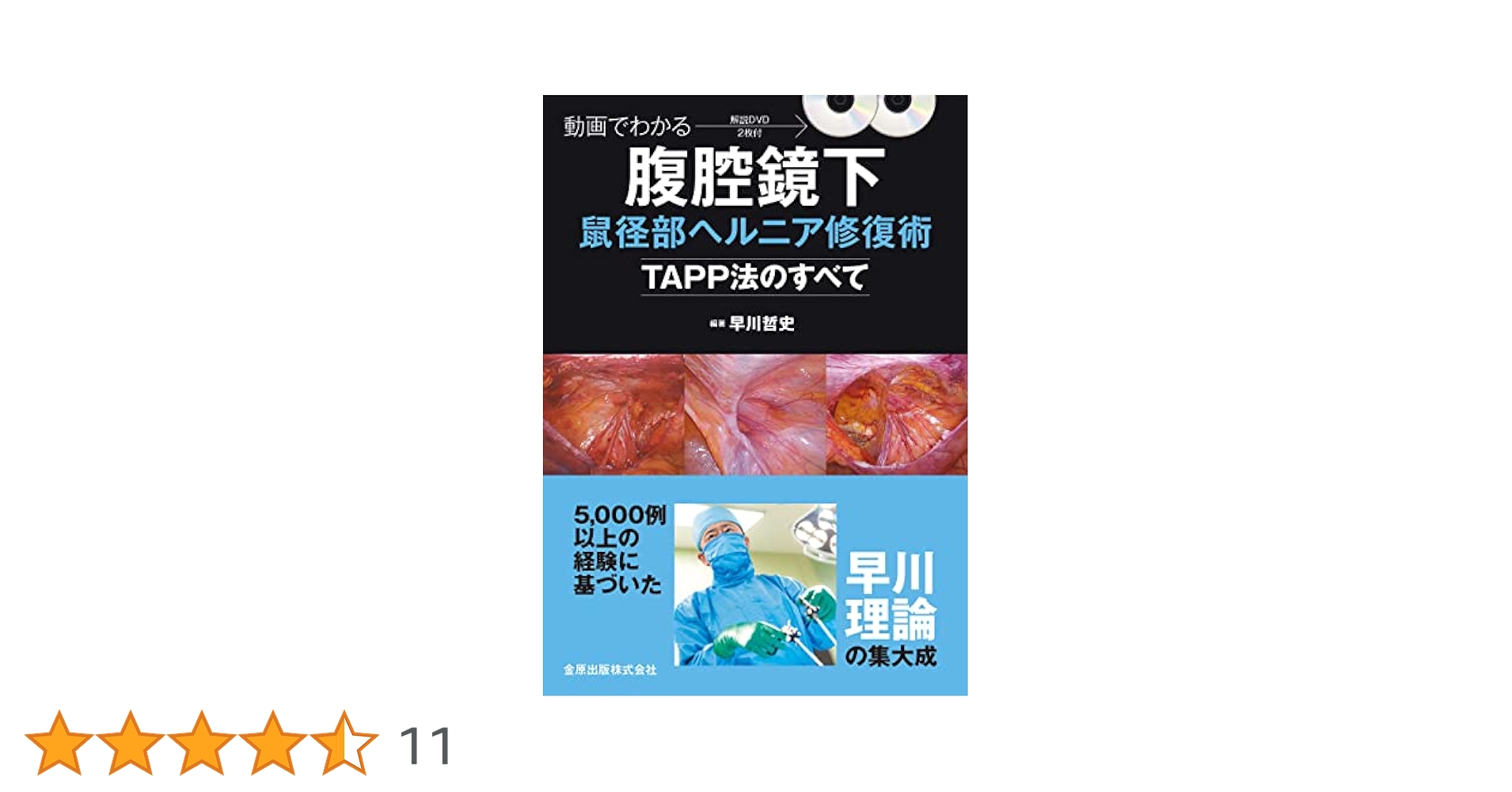 動画でわかる腹腔鏡下鼠径部ヘルニア修復術ーTAPP法のすべてー